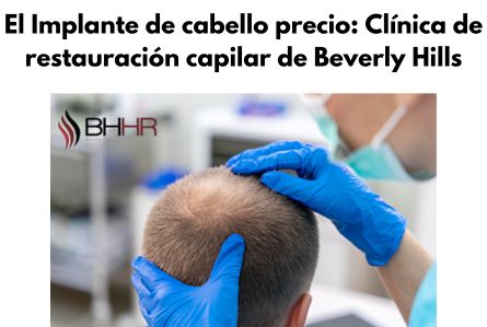 El Implante de cabello precio: Clínica de restauración capilar de Beverly Hills