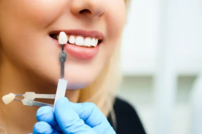 Common Cosmetic Dentistry Procedures in Louisville, KY
