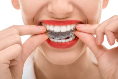 Invisalign: The clear path to a straighter smile