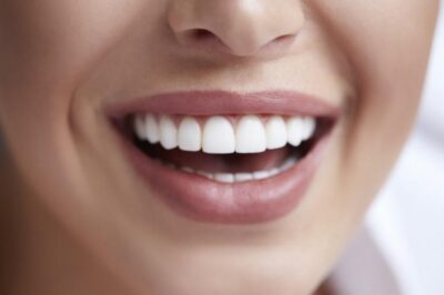 Regain Confidence with Dental Implants: Your Path to A Beautiful Smile