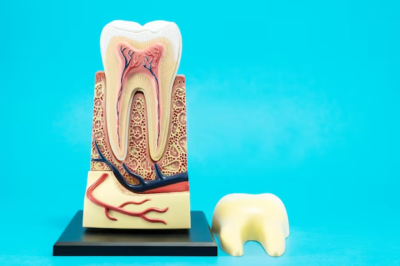 Comprehensive Guide to Root Canals in Lafayette, LA