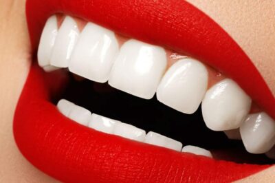Sparkling Smiles: Choosing the Best Teeth Cleaning Medical Center in Dubai
