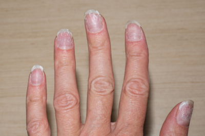 How to Hydrate and Moisturize Dry, Brittle Nails